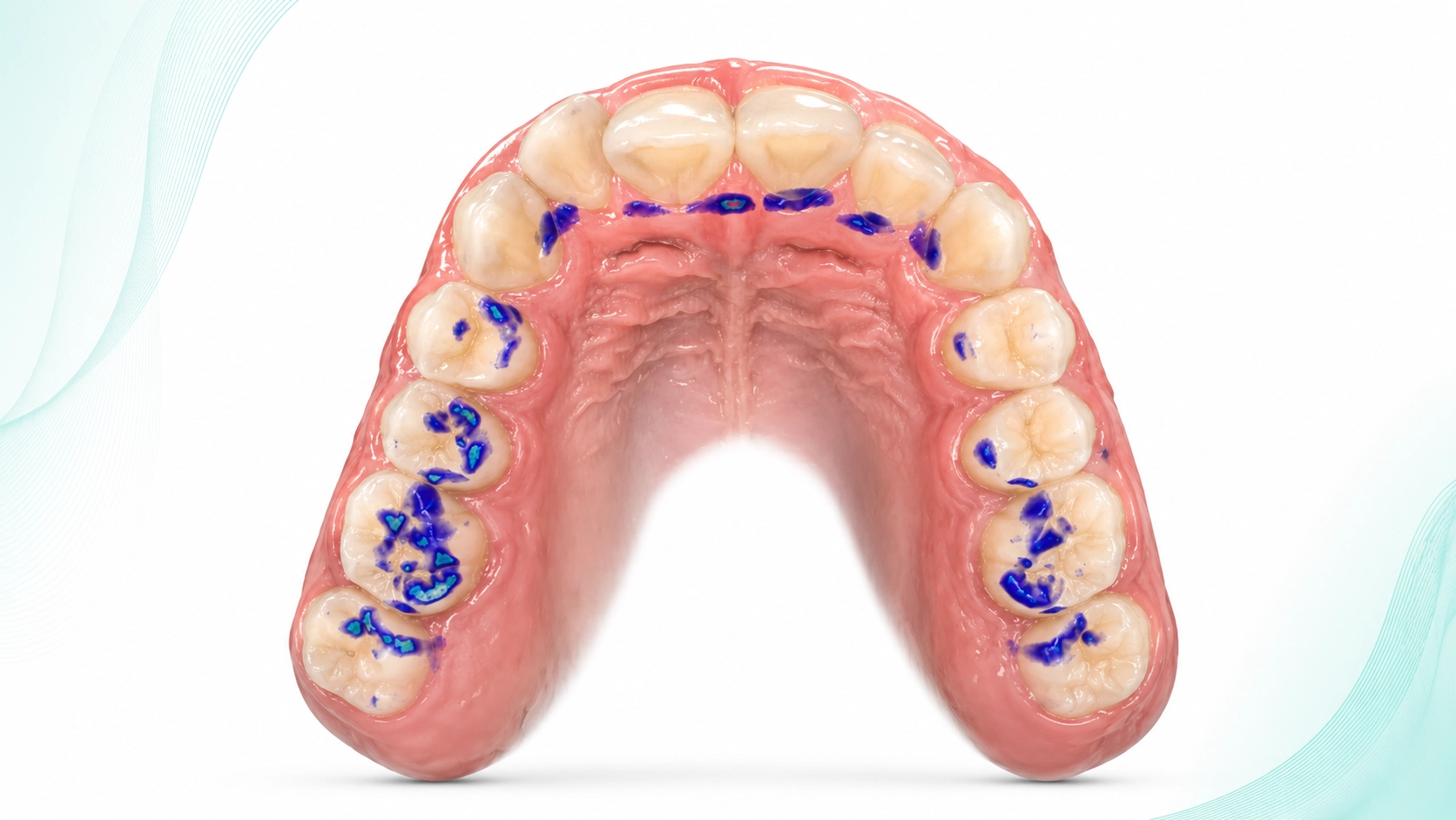 Visual de escáner intraoral para valoración dental en CEOC Curaçao