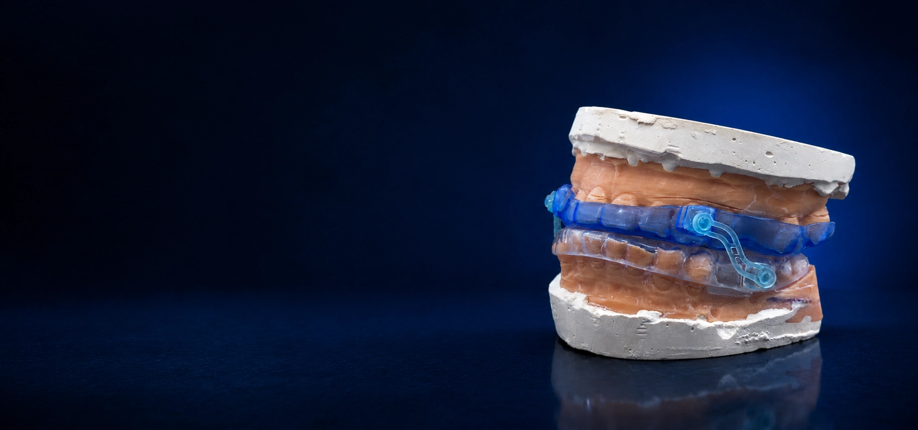 Dispositivo intraoral sobre modelos dentales para evaluación de apnea del sueño, ronquido y bruxismo en CEOC Curaçao